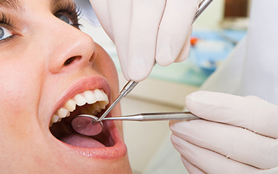 Dental procedure