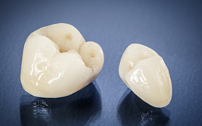 dental crowns