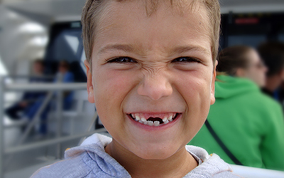 Young child smiling with missing teeth