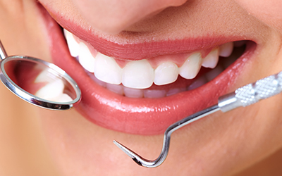 Upclose of a persons smile with dental tools