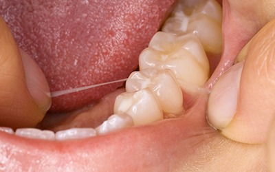 Up-close of teeth and gums with a person flossing